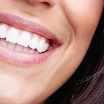 woman smiling with straight white teeth - teeth whitening offer clearfield dentists