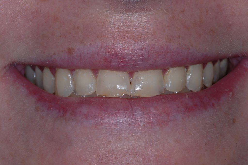 Presley H's after process photo